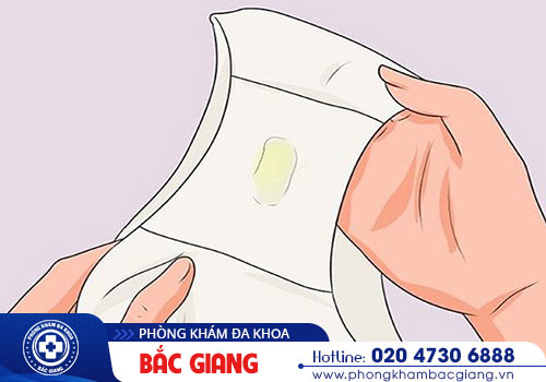 Âm đạo chảy mủ cảnh báo nữ giới mắc bệnh gì?