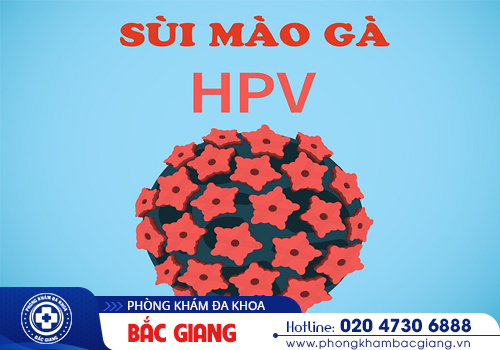 Bệnh HPV là gì? Tổng hợp những thông tin quan trọng nhất