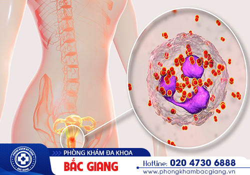 Bệnh lậu ở nữ dẫn đến những biến chứng gì?