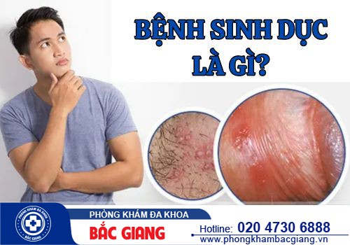 Bệnh sinh dục là gì? Chữa bệnh sinh dục ở đâu tốt?