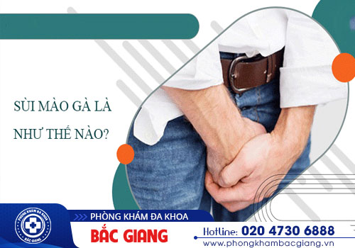 Bệnh sùi mồng gà là gì? Cách hỗ trợ điều trị bệnh sùi mồng gà hiệu quả