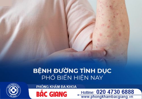 Các bệnh tình dục phổ biến - Khám bệnh tình dục ở đâu an toàn?