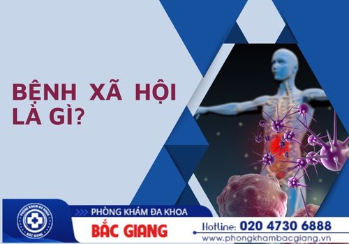 Các nguyên nhân gây bệnh xã hội thường gặp hiện nay