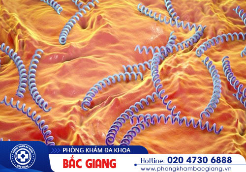 Biểu hiện của bệnh giang mai vùng kín là gì?
