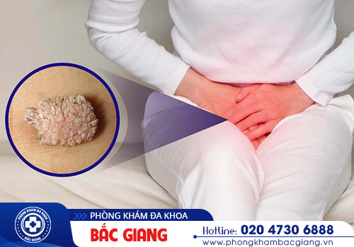Nhận biết biểu hiện sùi mào gà và phương pháp khắc phục sớm