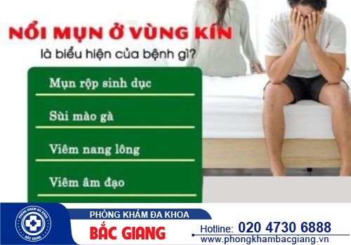 Tìm hiểu các loại mụn ở vùng kín phổ biến hiện nay