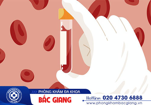 Chi phí xét nghiệm bệnh hpv bao nhiều tiền?