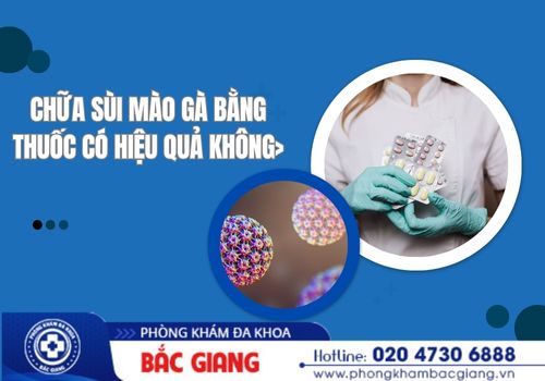 Chữa sùi mào gà bằng thuốc có hiệu quả không?