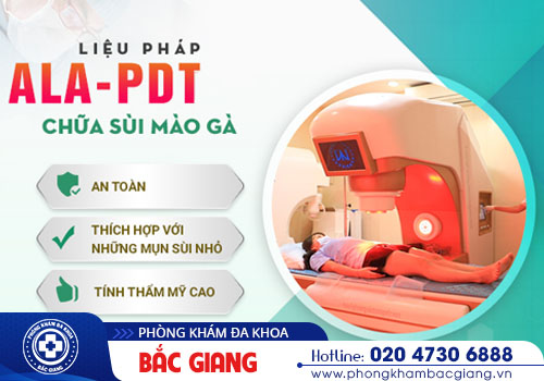 Top những cách chữa sùi mào gà hiệu quả hiện nay