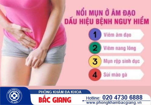 Khắc phục tình trạng cô bé bị nổi mụn hiệu quả tại Đa Khoa Bắc Giang