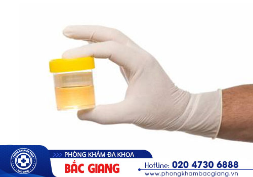 Đái ra mủ - Coi chừng mắc bệnh lậu