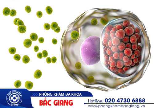 Dấu hiệu bệnh Chlamydia ở nam và nữ thế nào?