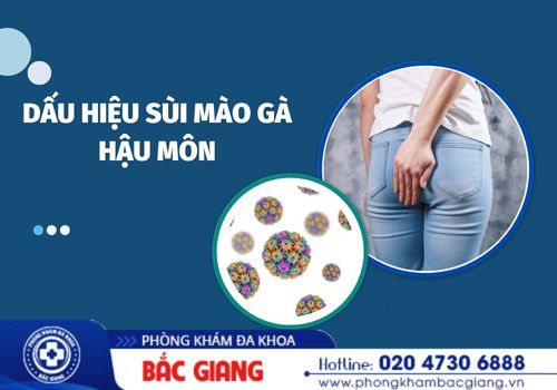 Những dấu hiệu sùi mào gà hậu môn điển hình