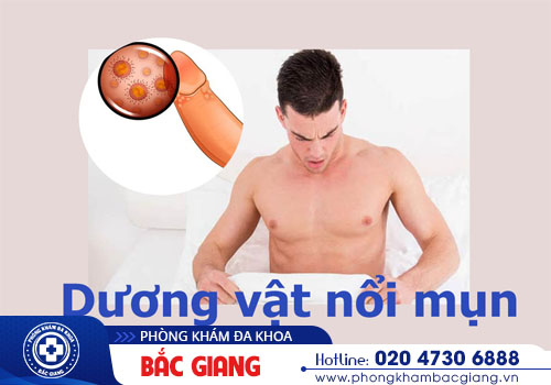 Dương vật nổi mụn trắng có phải là bệnh lý nguy hiểm?