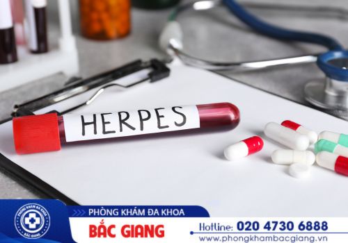 Herpes sinh dục là gì và những tác hại nguy hiểm