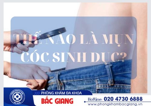 Cách Chữa Mụn Cóc Sinh Dục – Giải Pháp Hiệu Quả & An Toàn