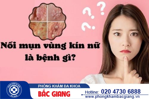Nổi mụn ở mu vùng kín là bị gì? Nguyên nhân và cách khắc phục