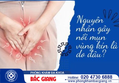 Mụn vùng kín là dấu hiệu bệnh gì? Cách chữa mụn vùng kín hiệu quả hiện nay