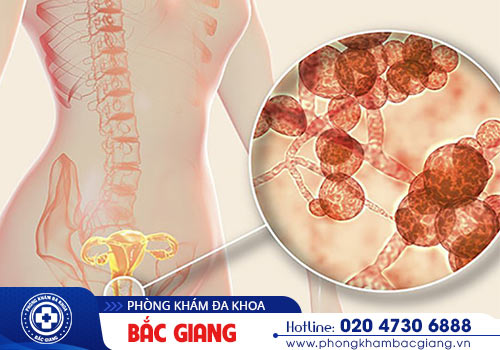 Nguyên nhân từ đâu gây ra chảy mủ vùng kín?