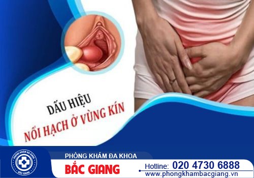 Bị nổi hạch ở vùng kín có sao không? Điều trị cách nào hiệu quả?