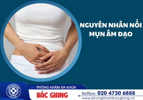 Nổi mụn âm đạo và những nguyên nhân thường gặp
