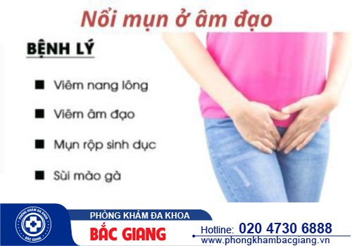 Mụn thịt âm đạo: Nguyên nhân và cách điều trị như thế nào?