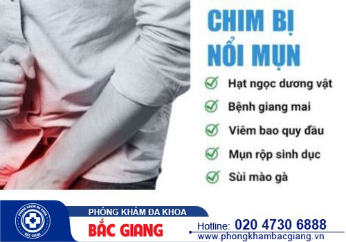 Nguyên nhân nổi mụn ở bộ phận sinh dục nam - Phương pháp điều trị như thế nào?