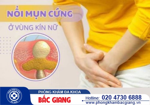 Mọc mụn cứng ở vùng kín là bị bệnh gì? Trị như thế nào hiệu quả?
