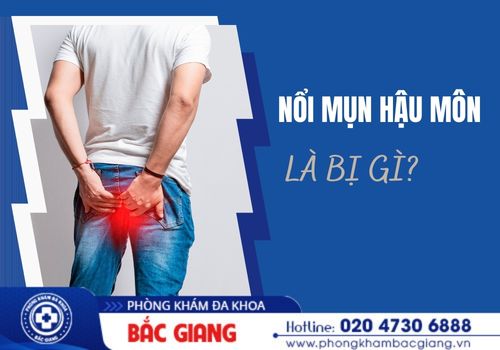 nổi mụn hậu môn