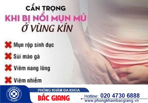 Bị nổi mụn mủ ở vùng kín có nguy hiểm không? Cách điều trị bệnh hiệu quả