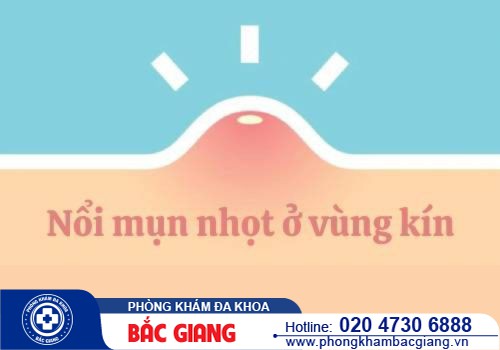 Mụn nhọt ở vùng kín là dấu hiệu bệnh gì? Cách chữa trị ra sao?