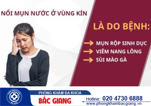 Âm đạo nổi mụn nước do bệnh gì gây ra? Cách điều trị ra sao?