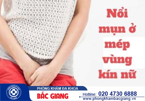 Nguyên nhân nổi mụn ở mép vùng kín nữ - Điều trị cách nào hiệu quả?