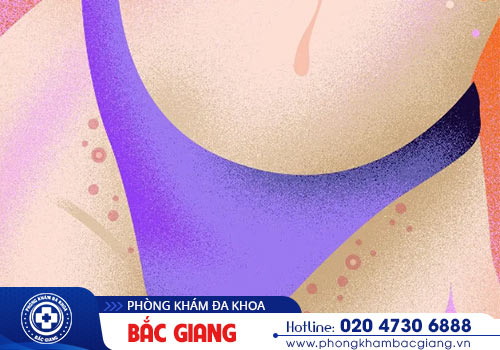 Nổi mụn vùng kín nữ bắt nguồn từ đâu?