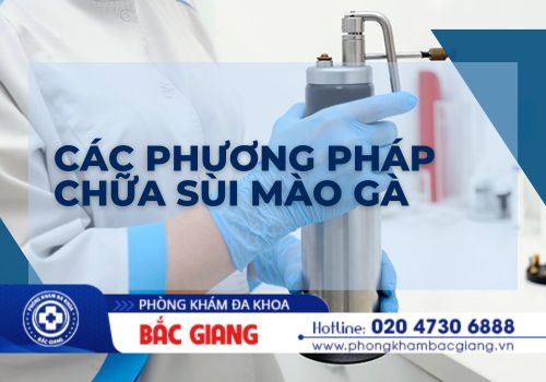 Các phương pháp chữa sùi mào gà được áp dụng hiện nay