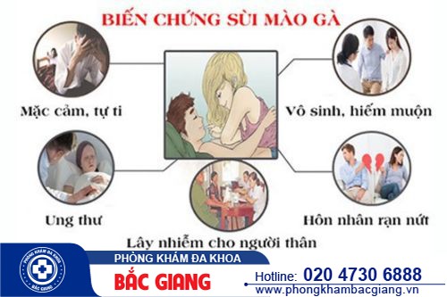 Những tác hại bệnh sùi mào gà không thể xem thường