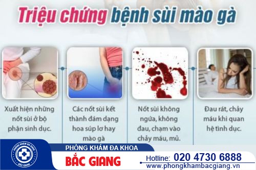 Sùi mào gà có tự khỏi không? Điều trị cách nào hiệu quả?