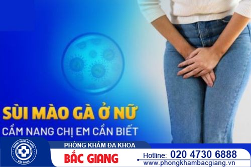 Sùi mào gà chữa được không? Cách chữa bệnh sùi mào gà ở nữ giới hiệu quả