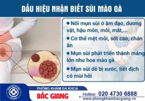 Bị sùi mào gà phải làm sao? Chữa sùi mào gà ở đâu mới hiệu quả?