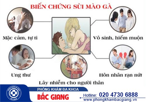 Phòng khám chữa sùi mào gà nào hiệu quả? Sùi mào gà gây biến chứng gì?