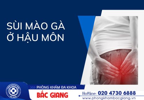 Dấu hiệu nhận biết sùi mào gà hậu môn