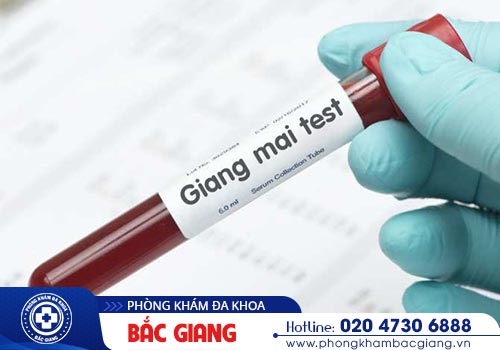Tìm hiểu phương pháp xét nghiệm bệnh giang mai nhanh chóng chính xác