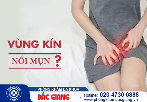 Vùng kín nổi mụn nước do đâu? Phương pháp nào điều trị hiệu quả?