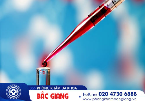 Xét nghiệm bệnh hpv là gì và tại sao phải thực hiện?