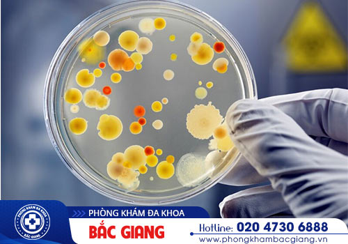 Xét nghiệm bệnh lậu gồm những cách nào?
