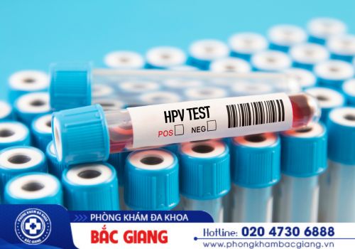 Địa chỉ xét nghiệm bệnh sùi mào gà uy tín hiện nay